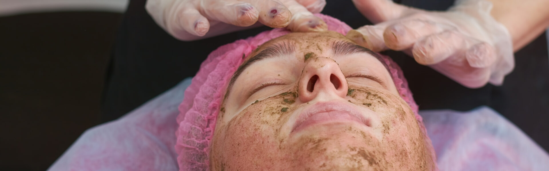 peeling medyczny zabieg